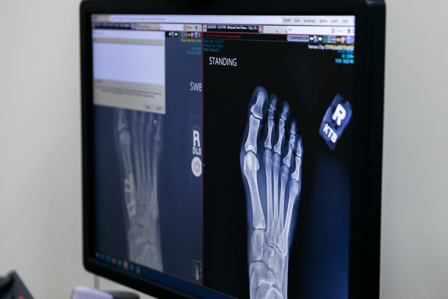 Foot & Ankle Kansas City Orthopedic Alliance